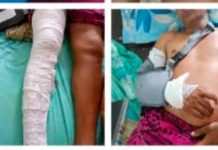 अडेगाव येथे ईसमावर प्राणघातक हल्ला.