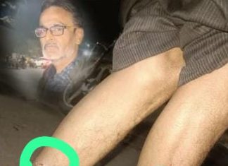 वणी शहरात मोकाट कुत्र्यांचा हैदोस, भर चौकात रात्री घेतला एकाला चावा.